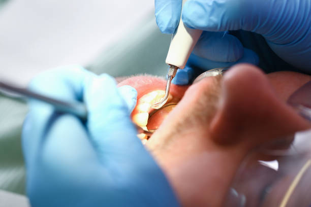 Best Knocked-Out Tooth Emergency  in Wright, FL